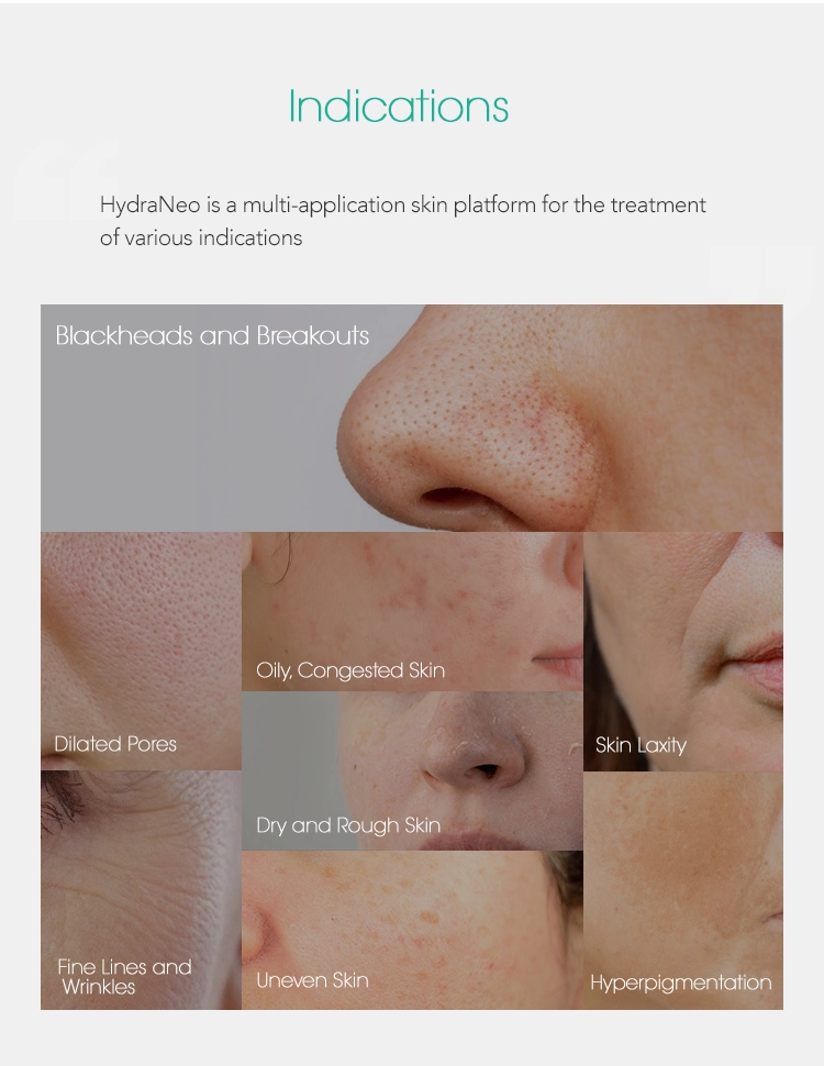 Face Lift Feature Aqua Peel Beauty SPA Oxygen Facial Dermabrasion Machine